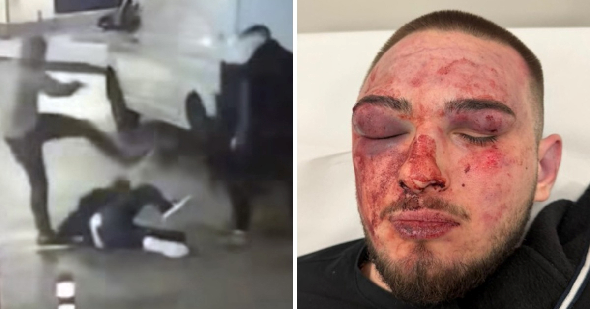 U Rijeci pretučen 16-godišnjak. "Skakali su po njemu, udarali ga dok je bio na podu"