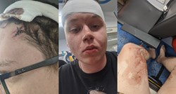 Student: Radnik aquaparka u Umagu me udario veslom po glavi, šikljala je krv