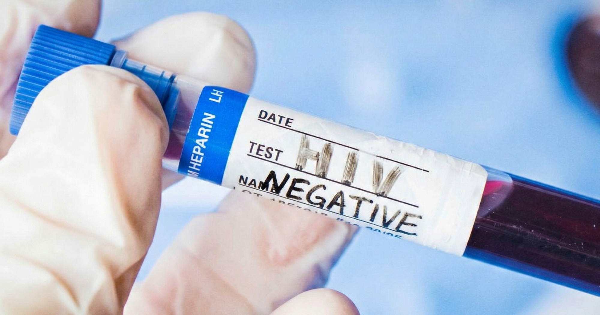 Pacijent iz Osla u remisiji od HIV-a nakon transplantacije matičnih stanica