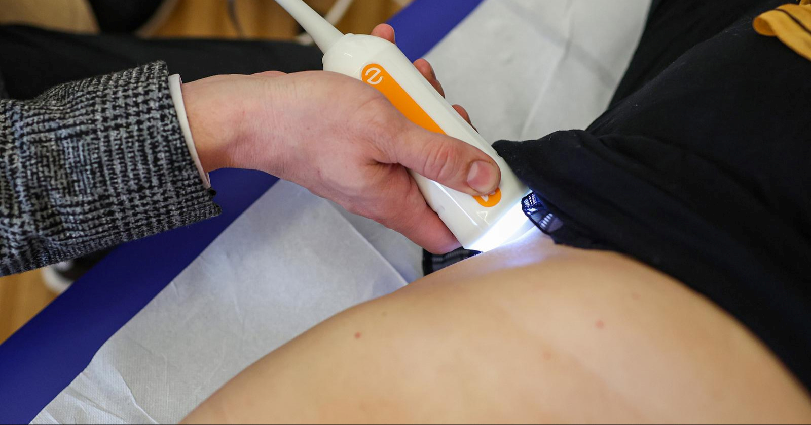 Sve više Hrvata ima masnu jetru. Mnogi toga uopće nisu svjesni