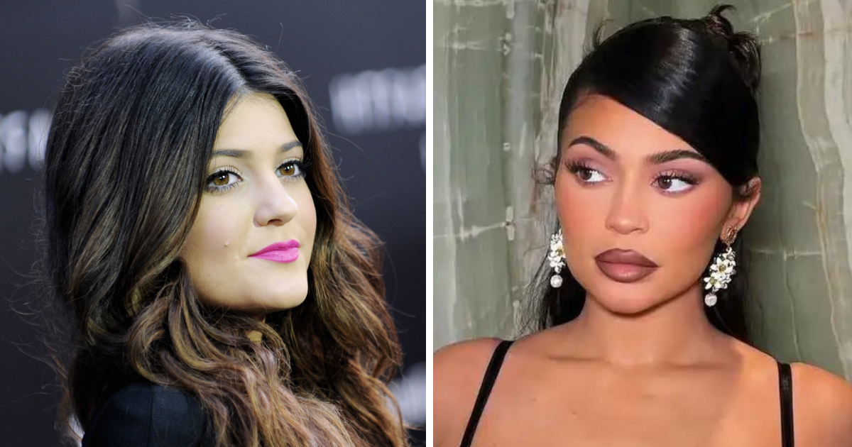 Kylie Jenner: Nisam se toliko operirala. Lice mi je uglavnom prirodno
