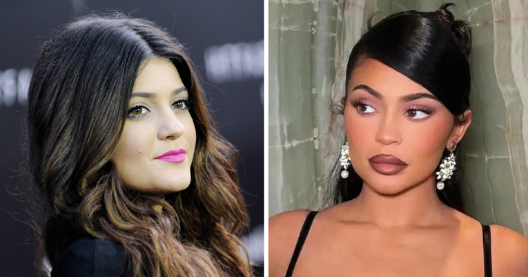 Kylie Jenner: Nisam se toliko operirala. Lice mi je uglavnom prirodno