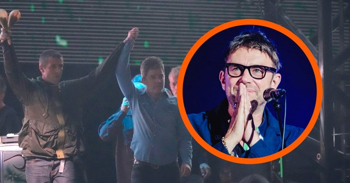 Frontmen Blura: Oasis je pobijedio, priznajem poraz