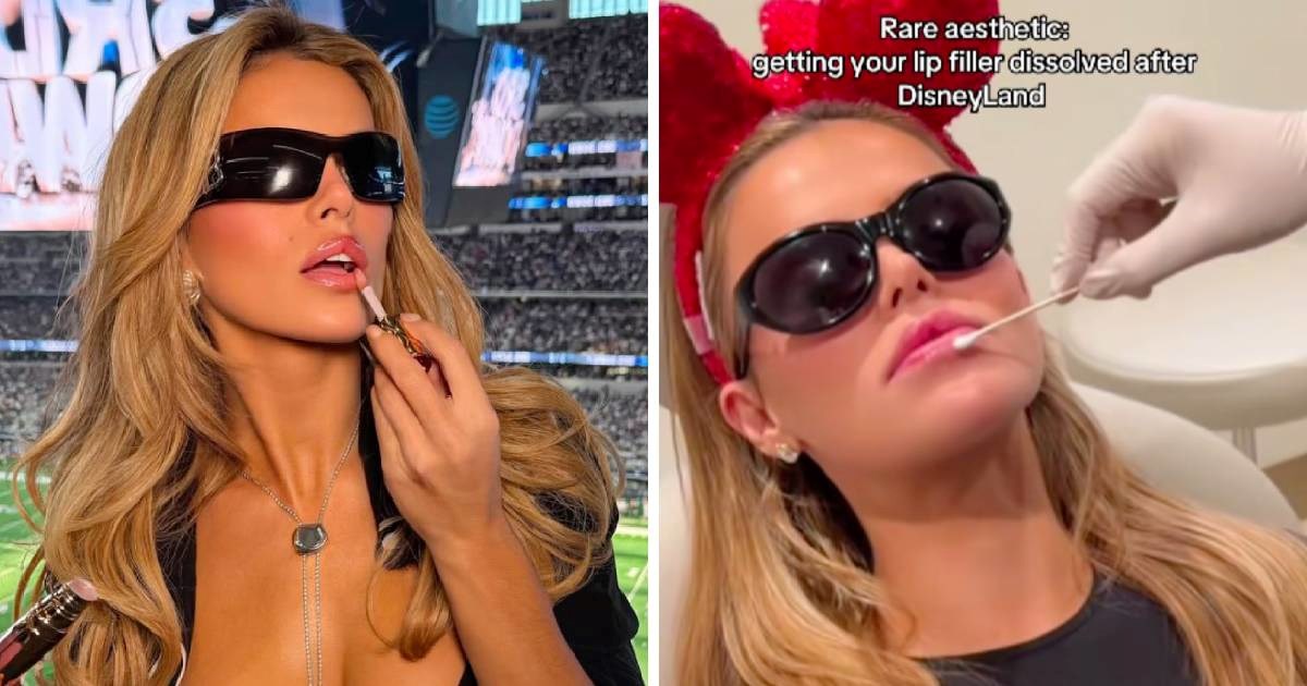 Brooks Nader uklonila filere iz usana: "Božićni poklon mami i tati"