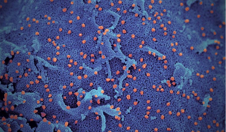 Ovako izgleda koronavirus pod mikroskopom
