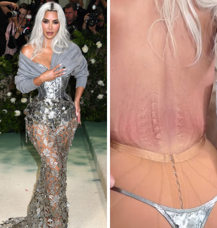 Kim K. o korzetu s Met Gale: Mislila sam da ću povratiti. Pokazala i ožiljke