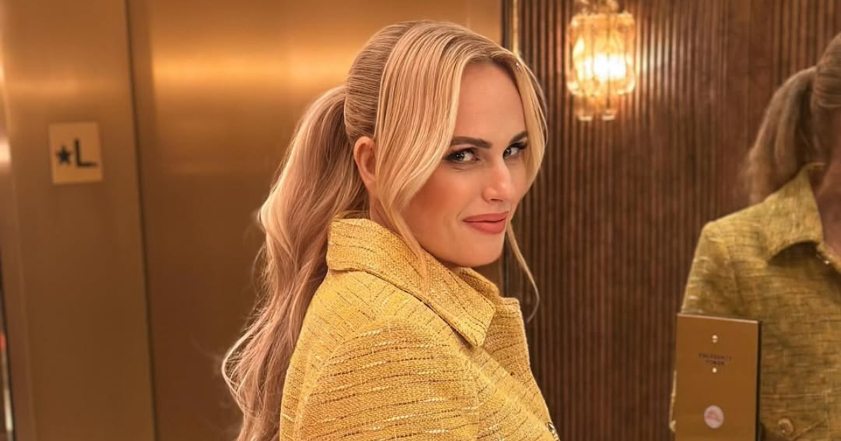 Rebel Wilson završila s razrezanim nosom na setu: "Bila sam prestravljena"