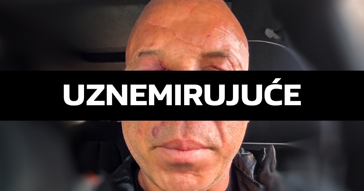 Wanderlei Silva nakon makljaže: Ne mogu obaviti poslove zbog lica. Idem na sud