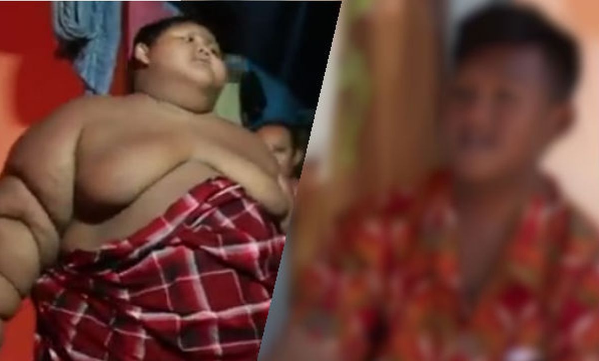 Najdeblji dječak na svijetu izgubio je 100 kilograma, ali sad ima drugi problem