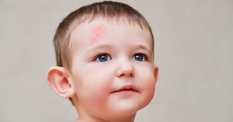 Bolničarka: Ovo su znakovi da dijete treba hitnu pomoć ako je udarilo glavom