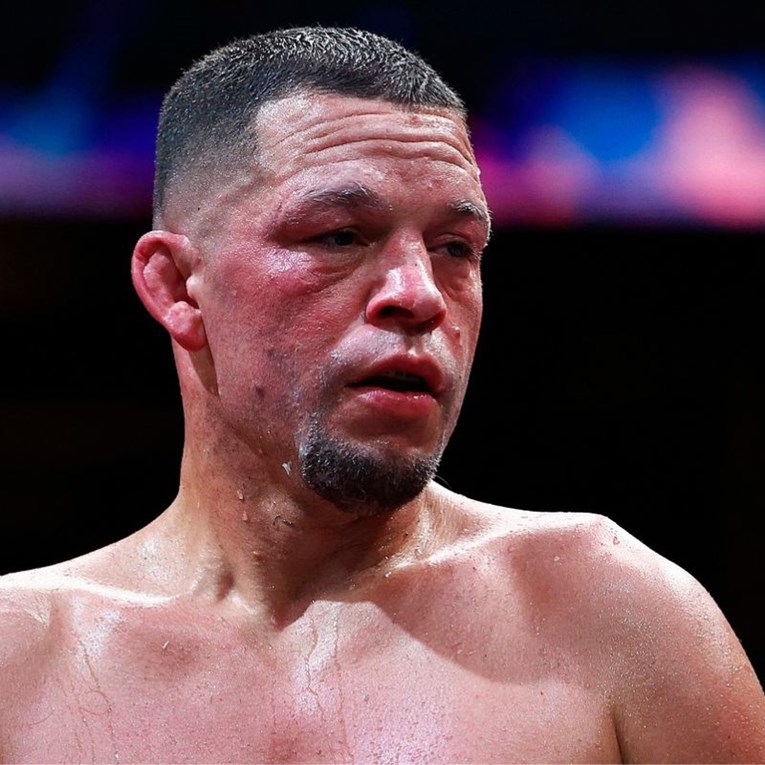 Diaz uložio 20 tisuća dolara na bizarnu okladu. Može dobiti 142 000 dolara