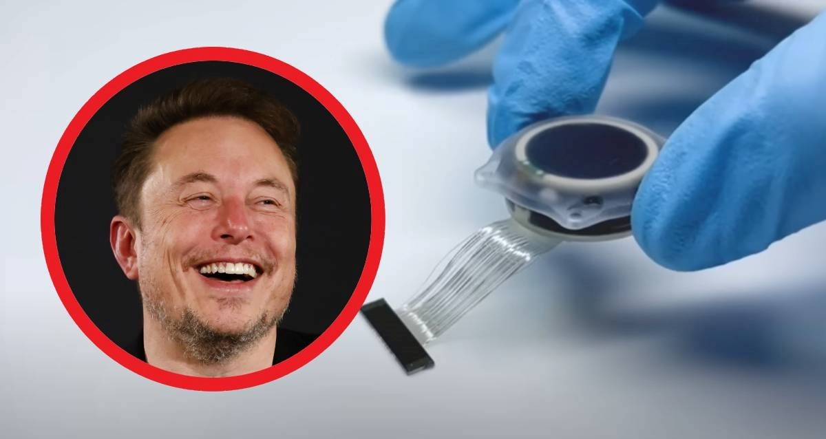 Musk je ugradio prvi čip u čovjeka. Kad će to postati masovno?