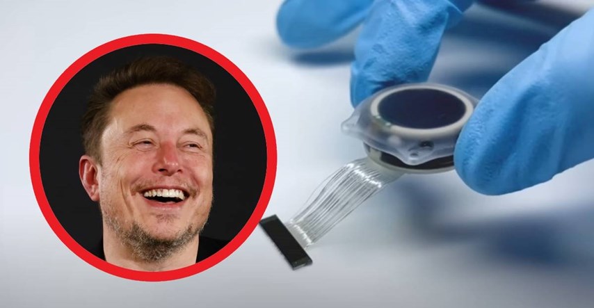 Musk je ugradio prvi čip u čovjeka. Kad će to postati masovno?