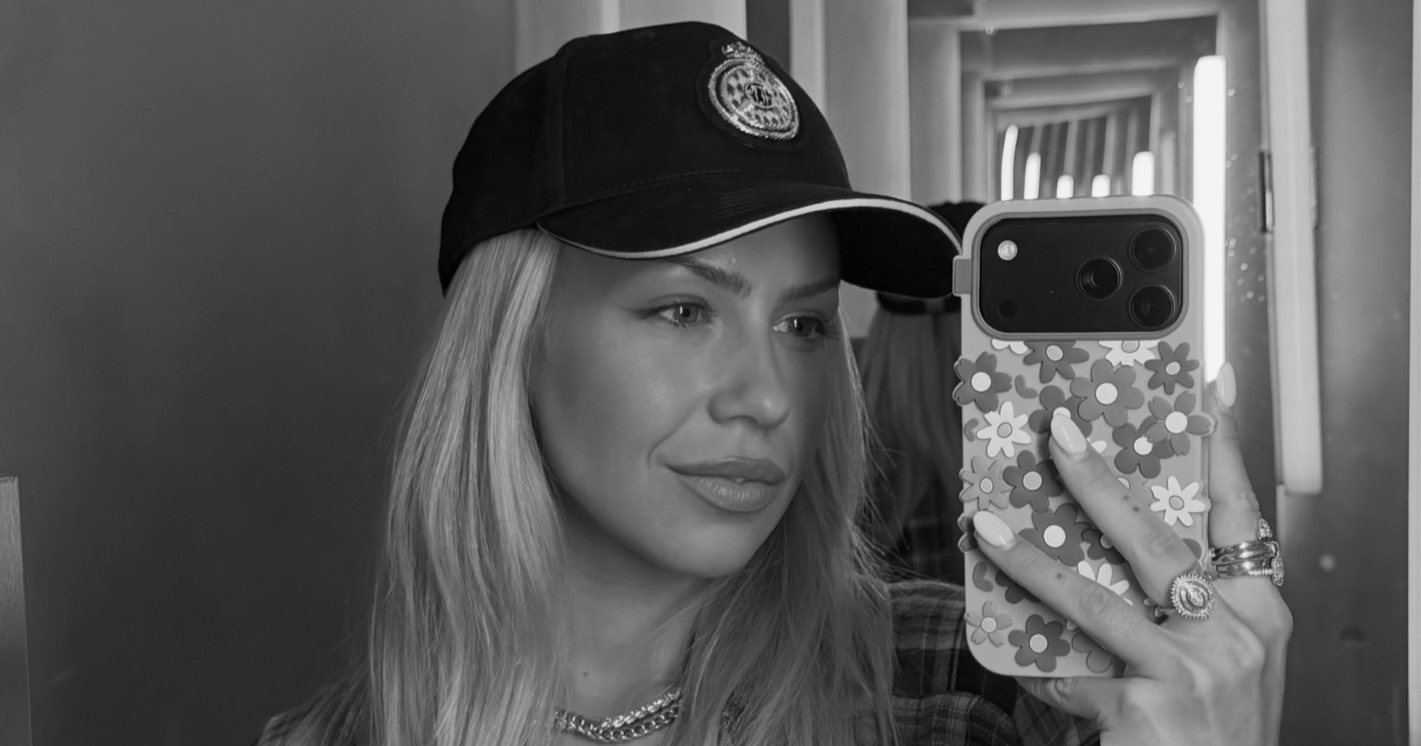 Finska influencerica Olivia Oras (27) umrla tijekom estetskog zahvata