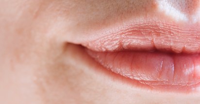Tri znaka u ustima koja bi mogla signalizirati nedostatak vitamina B12
