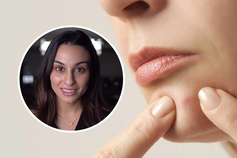 Dermatologinja otkriva: Što vaša koža govori o vašem zdravlju?