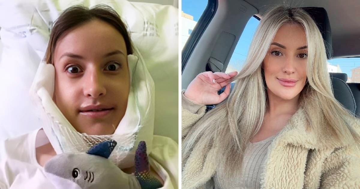 Hrvatska vizažistica o operaciji čeljusti: Trajalo je pet sati, teško je psihički