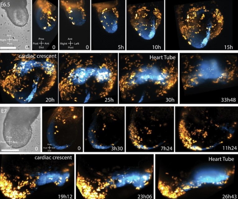 VIDEO Prvi put snimljeno kako nastaje srce: "Ovo iz temelja mijenja sve"