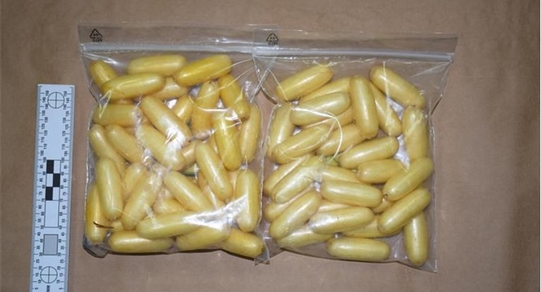 FOTO Brazilac progutao 117 kapsula s kokainom pa avionom došao u Zagreb. Uhićen je