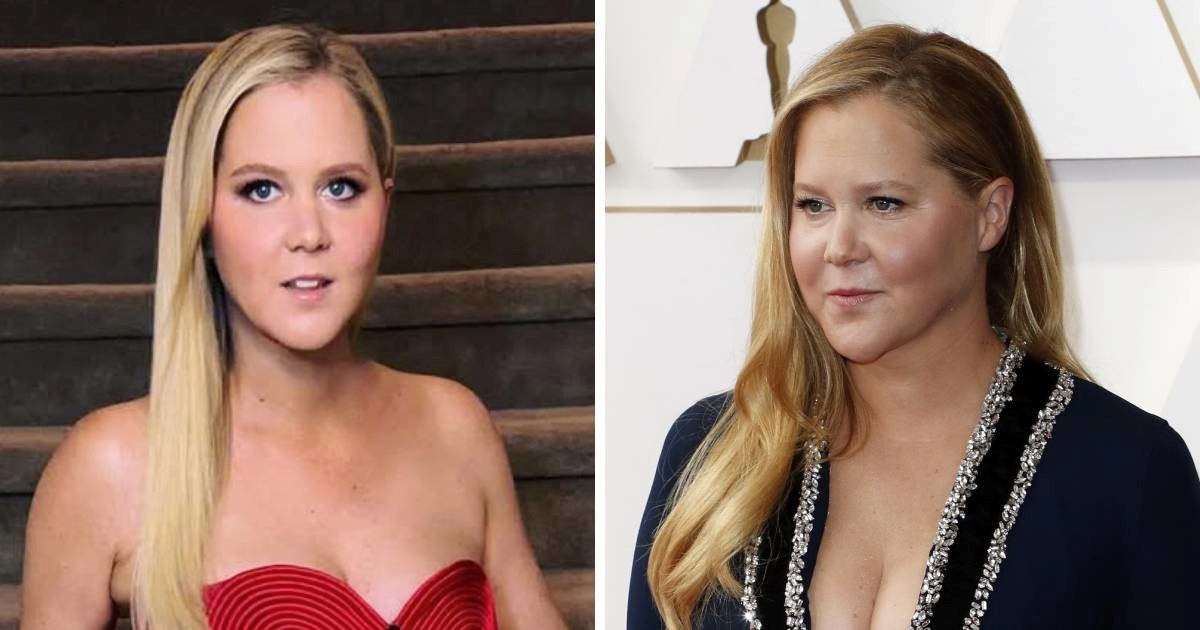 Nakon što je drastično smršavila, Amy Schumer obrisala sve stare fotke s Instagrama