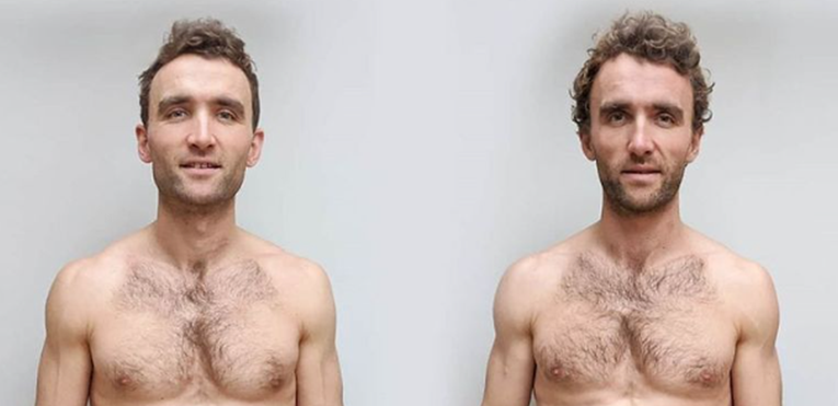 Jedan blizanac jeo samo vegansku hranu, drugi meso, nakon 12 tjedana otkrili razliku