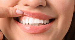 Stomatologinja otkrila pet stvari koje nikada ne radi svojim zubima
