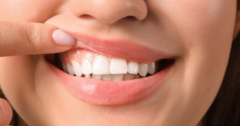 Stomatologinja otkrila pet stvari koje nikada ne radi svojim zubima
