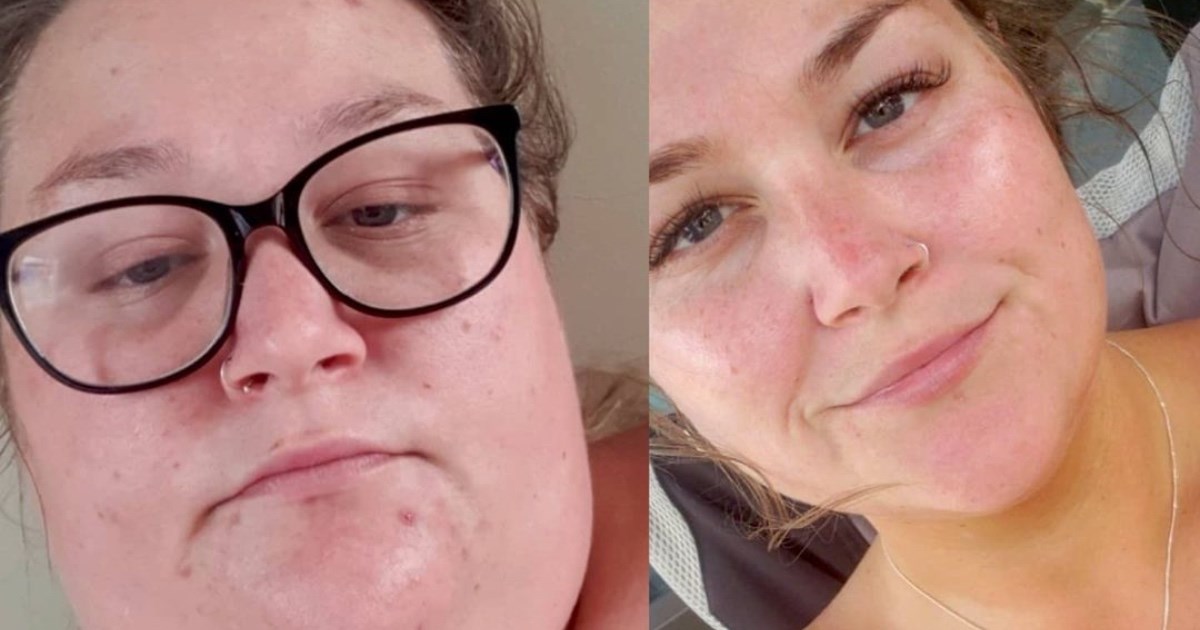 Dadilja koja je imala 170 kilograma pokazala nevjerojatnu transformaciju