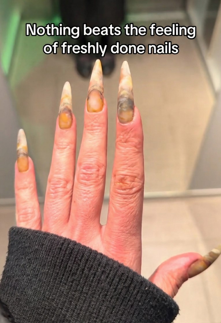 Pohvalila se manikurom, ljudi pišu: "Izgleda kao da imaš gljivice na noktima"