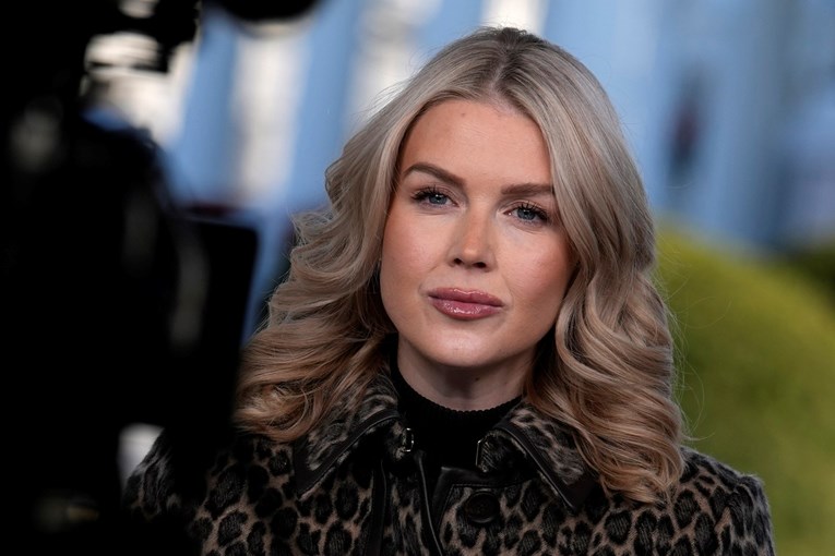 Što se dogodilo s usnama Karoline Leavitt?