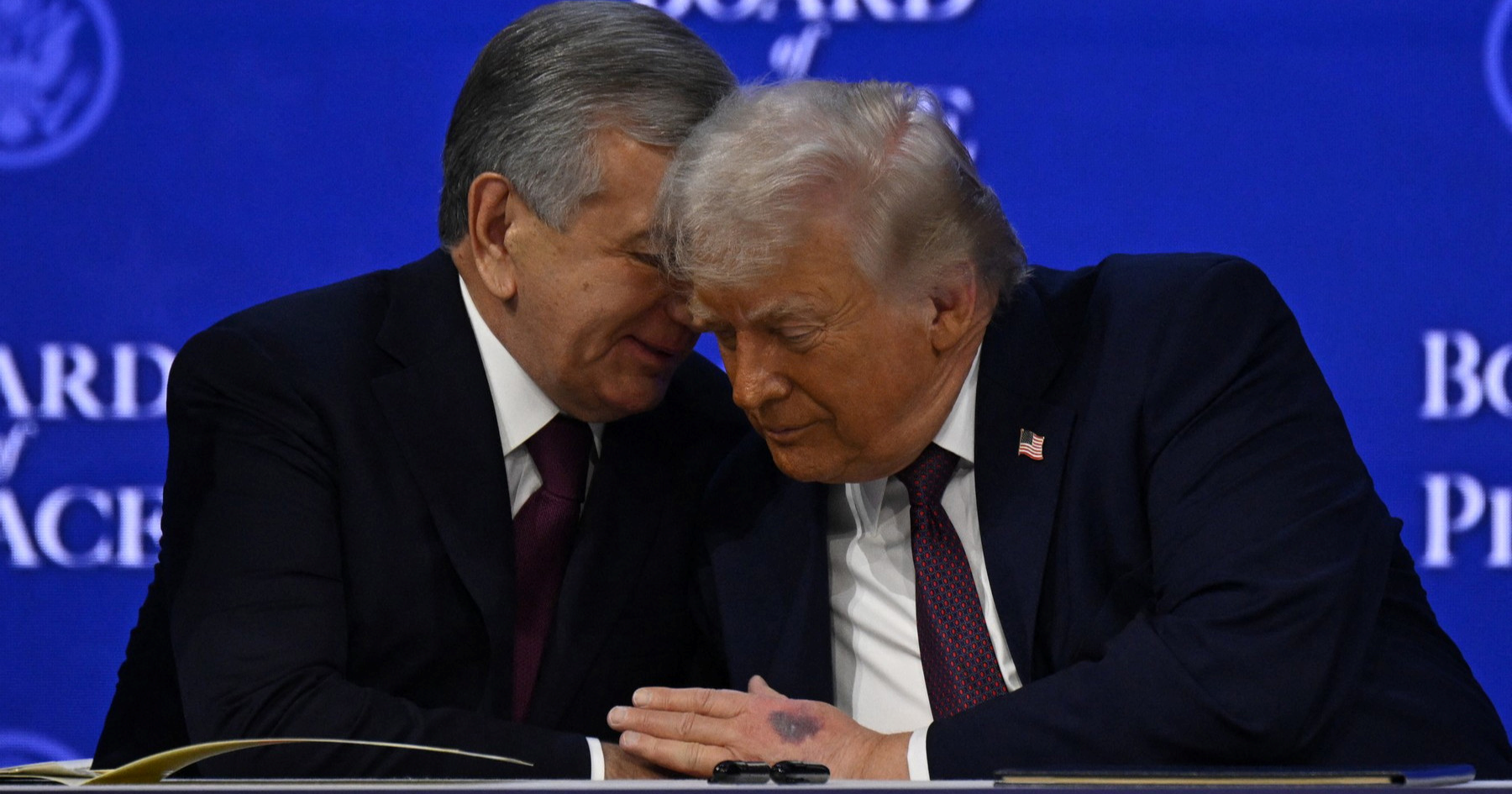 Ruke Donalda Trumpa ponovno su glavna tema. Bijela kuća objasnila zašto ima modricu