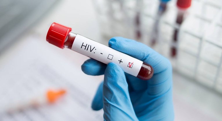 Znanstvenici: Uspjeli smo "izrezati" HIV iz stanica