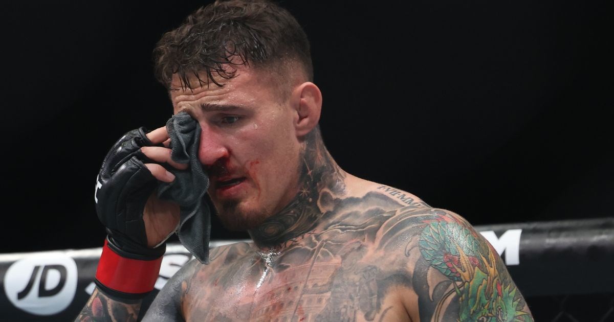 Aspinall otkrio stanje oka nakon dva opasna uboda