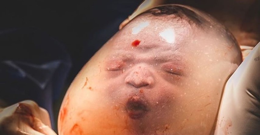 Beba se rodila u vrećici: "Plakala sam dok sam ga rađala"