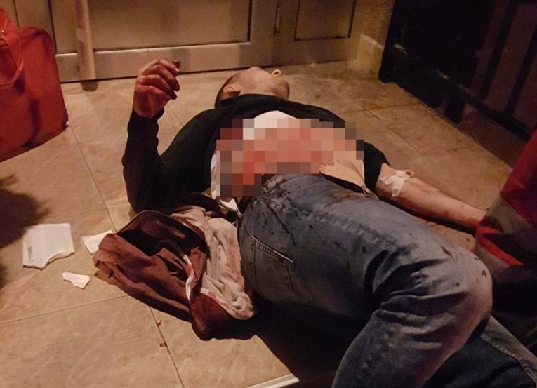 UZNEMIRUJUĆE Mladić izboden ispred zgrade u Beogradu, ležao u lokvi krvi