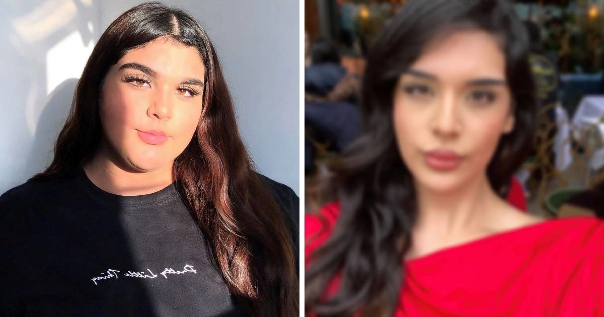 Smršavjela 57 kg, ljudi je optužuju da je varala: "Kažu da sam koristila injekcije"