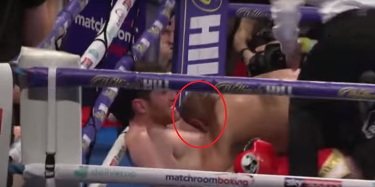 VIDEO Boksač ugrizao protivnika i tako izgubio prvu borbu u karijeri