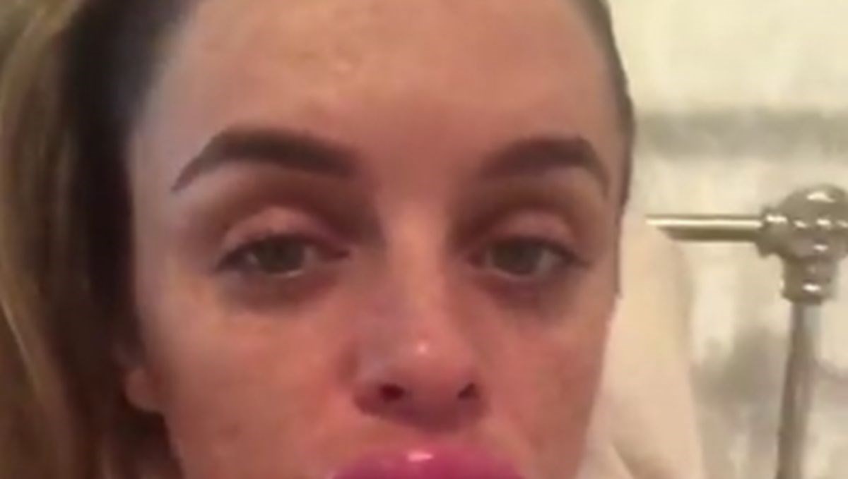 Ugradila filere u usne pa gadno požalila: "Ujutro su bile četiri puta veće"