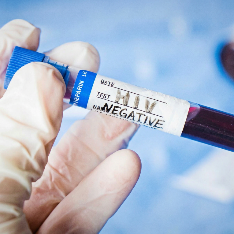 Transplantacija matičnih stanica pacijentu iz Osla dovela do rijetke remisije HIV-a