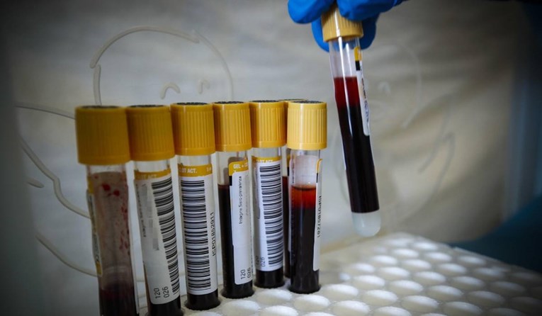 Izumljen test krvi koji može pokazati koliko ste depresivni