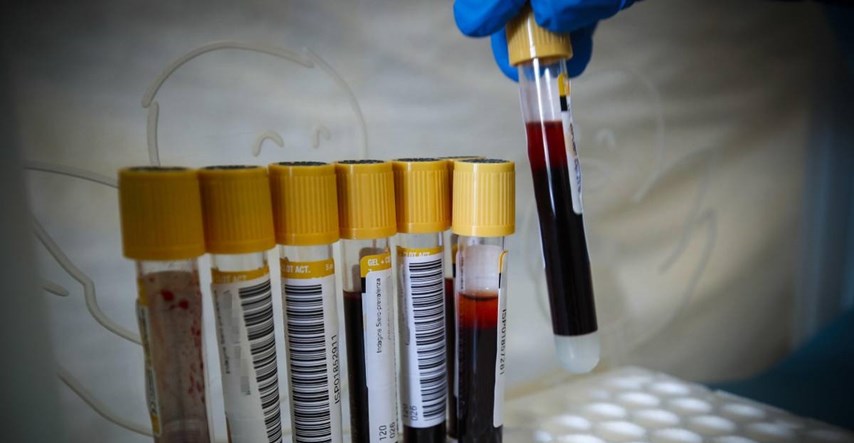 Izumljen test krvi koji može pokazati koliko ste depresivni