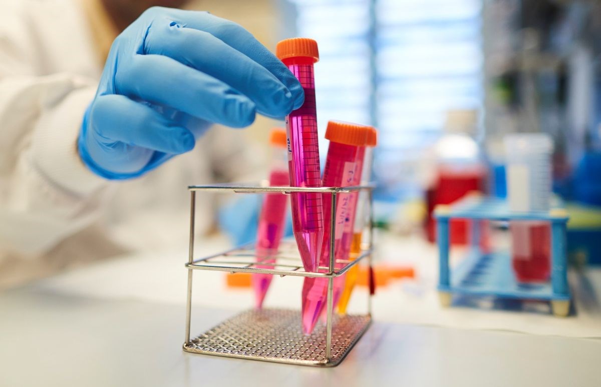 U Hrvatskoj tri osobe dnevno dobiju dijagnozu raka mjehura