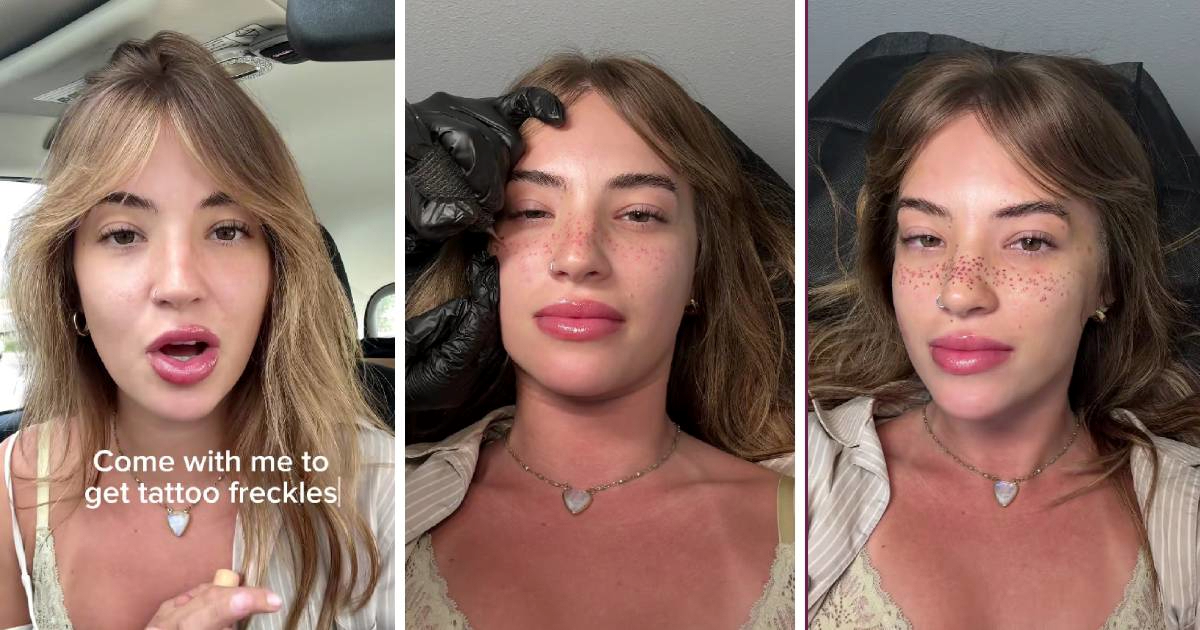 Influencerica tetovirala pjegice na licu i izazvala podijeljene reakcije na internetu
