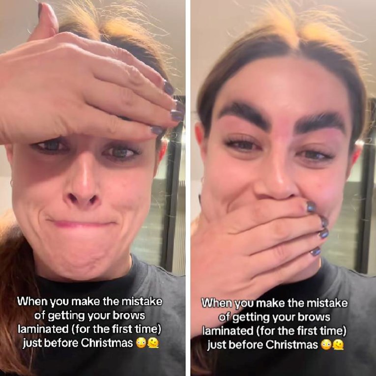 Otišla je na podizanje obrva pa pokazala rezultat, ljudi ostali u čudu