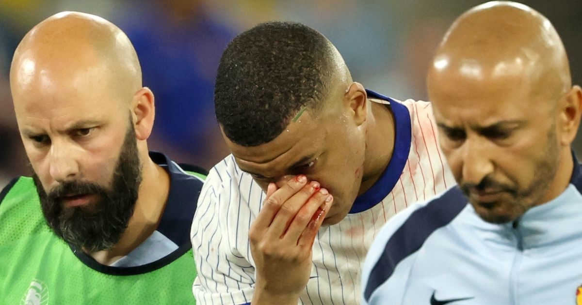 Pogledajte kako izgleda Mbappe s posebnom maskom