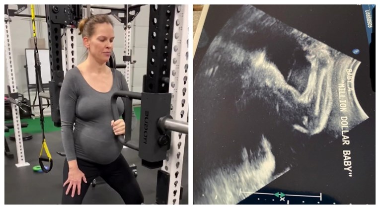 Trudna Hillary Swank objavila neobičnu sliku s ultrazvuka: "Beba napinje mišić..."