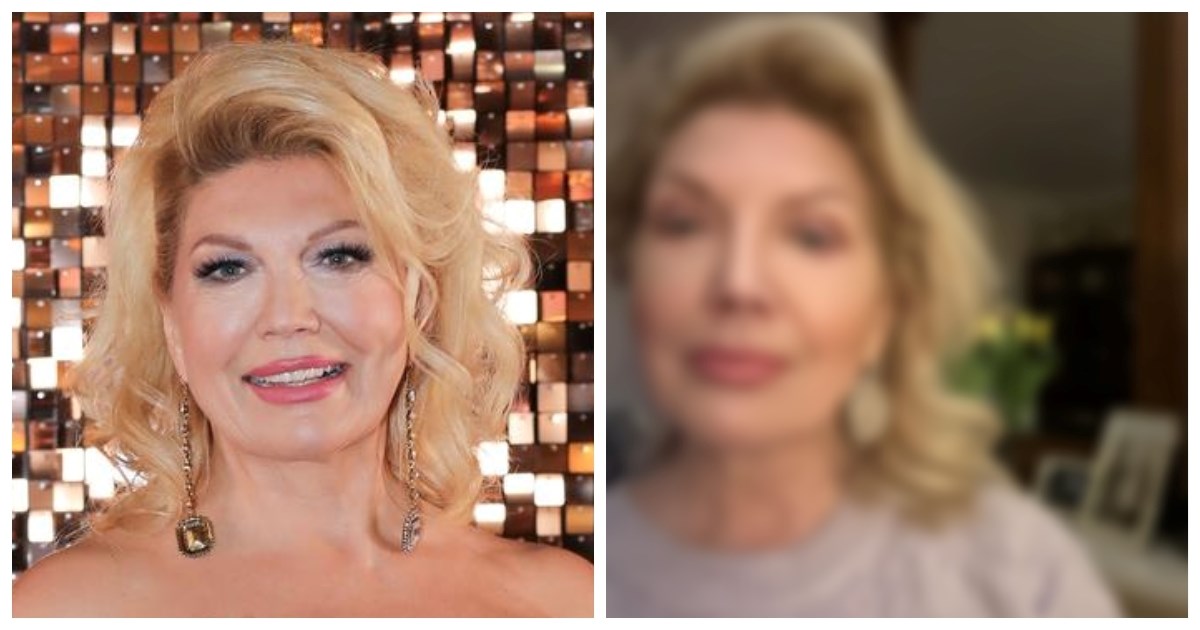 Najpoznatija loto djevojka bivše Juge pokazala kako izgleda nakon estetske operacije