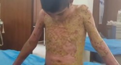 Dječaka u Siriji spalilo kemijsko oružje: "Tata, neka prestane, molim te"