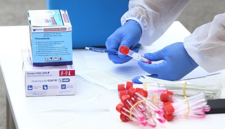 Objavljene nove, niže cijene testova na koronavirus