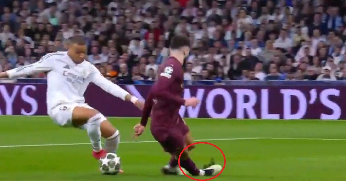 Mbappe je poslao Gvardiola u prazno. Pogledajte gležanj najskupljeg braniča